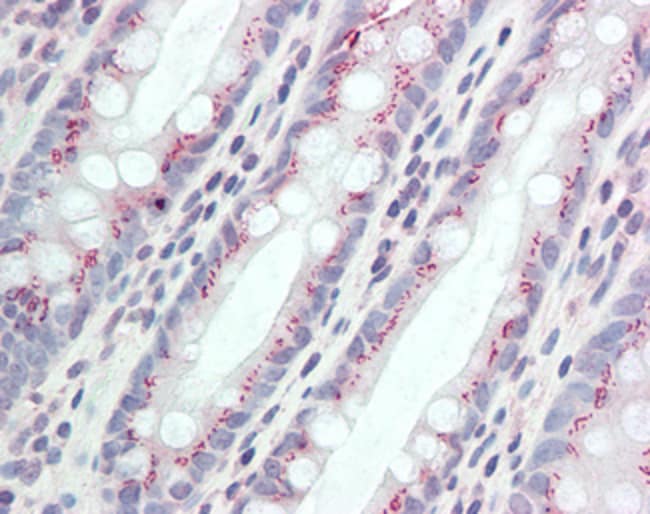 100 UG CCDC3 Antibody