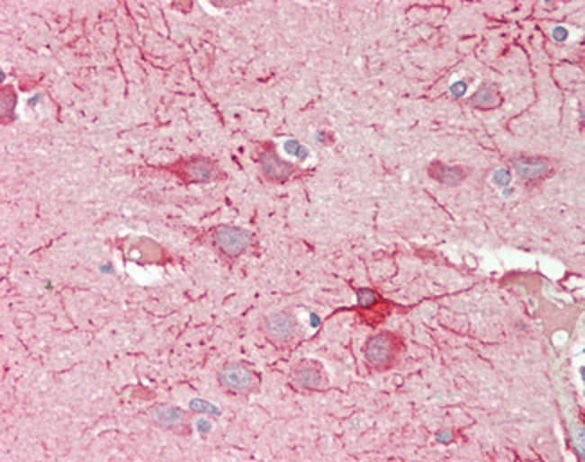 100 UG CROT Antibody