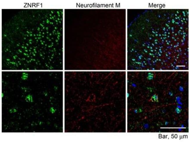 100 UG ZNRF1 Antibody