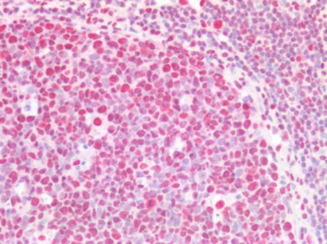 100 UG beta CstF-64 variant Antibody