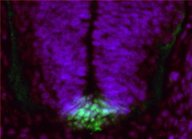 100 UG FERD3L Antibody