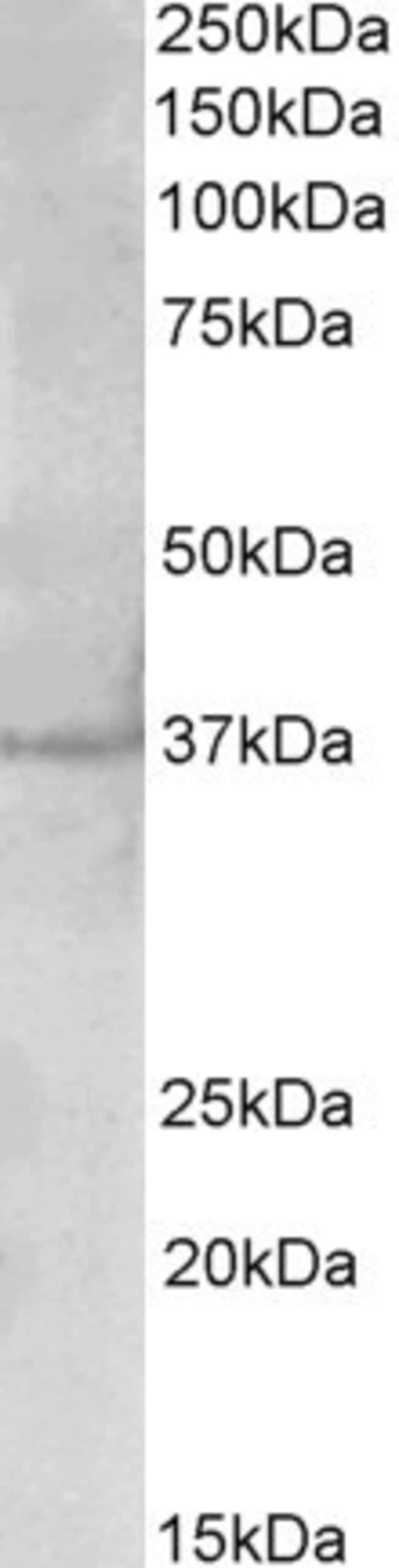 100 UG PLK5 / Polo-like Kinase 5 Antibod