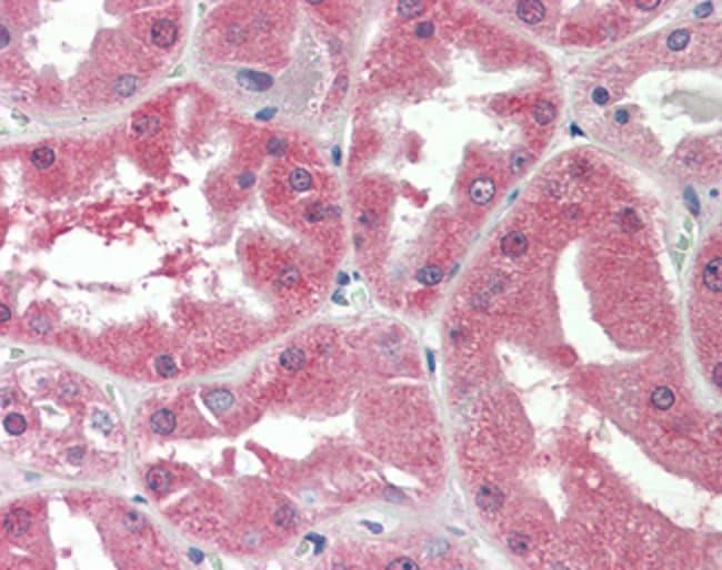 100 UG SLC47A2 / MATE-2 Antibody