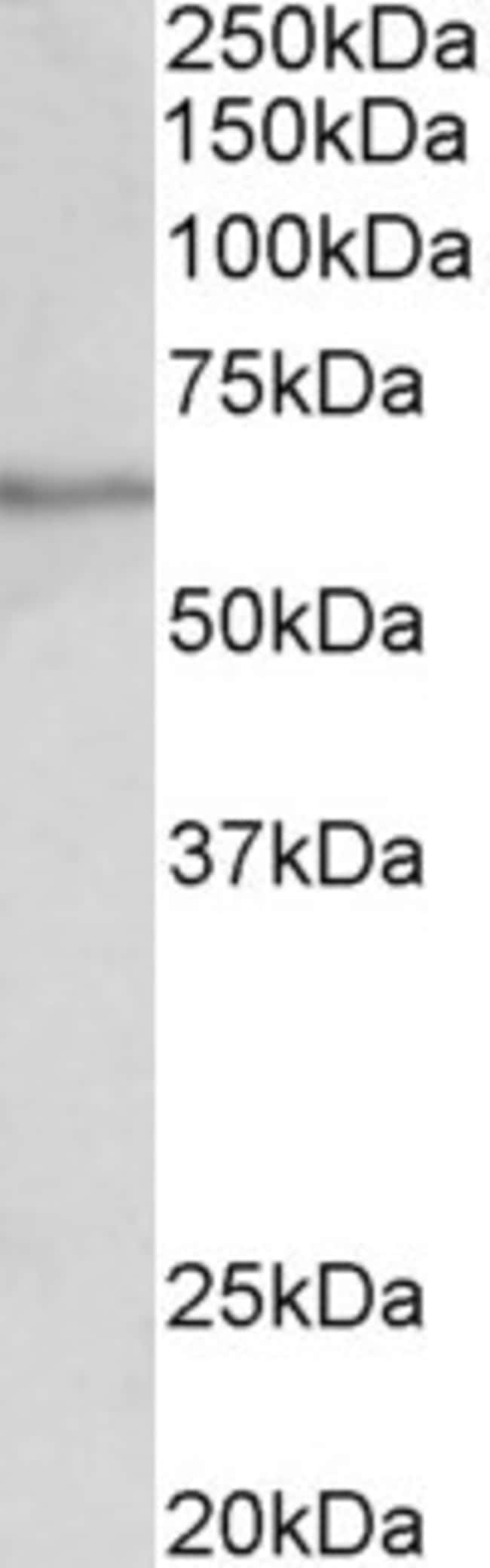100 UG SLC47A2 / MATE-2 Antibody