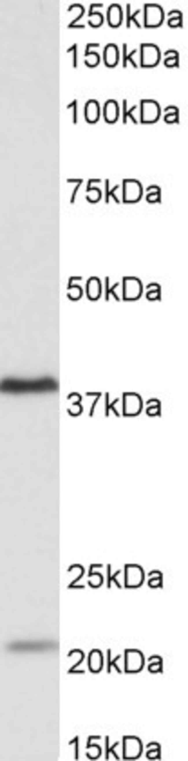 100 UG KLHDC8B Antibody