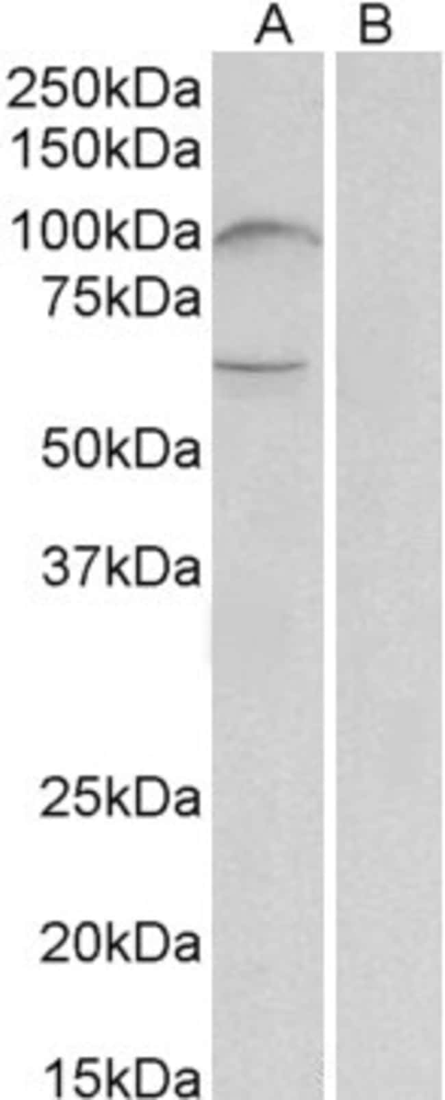 100 UG UNC5B Antibody