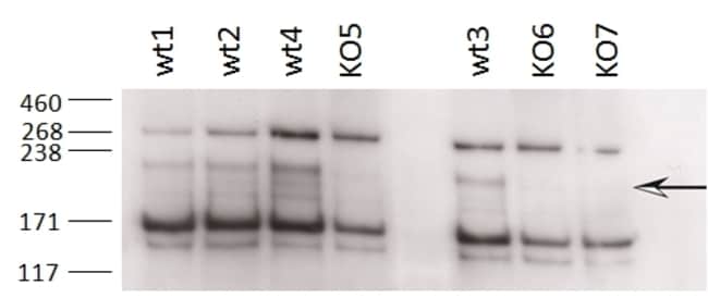 100 UG ZCCHC11 / TUT4 Antibody