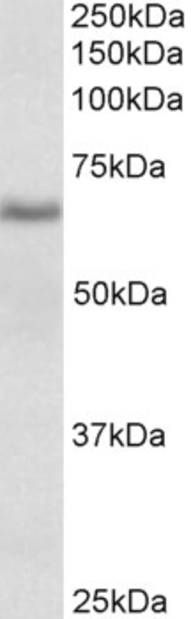100 UG CYB5R4 Antibody