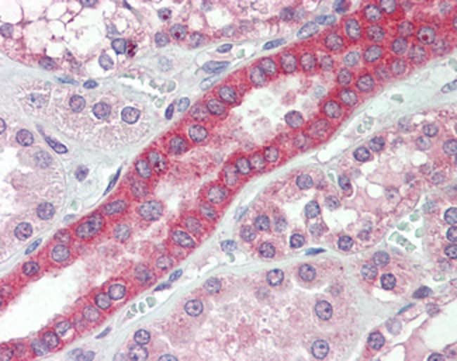 100 UG Myosin-1H Antibody