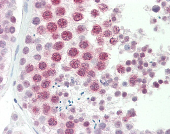 100 UG DNAJC5G Antibody