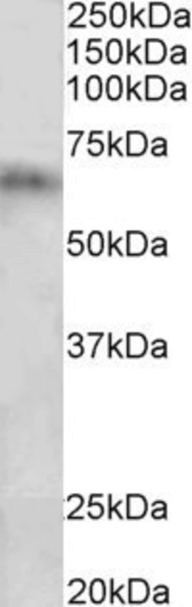 100 UG Cytochrome P450 2D10 Antibody
