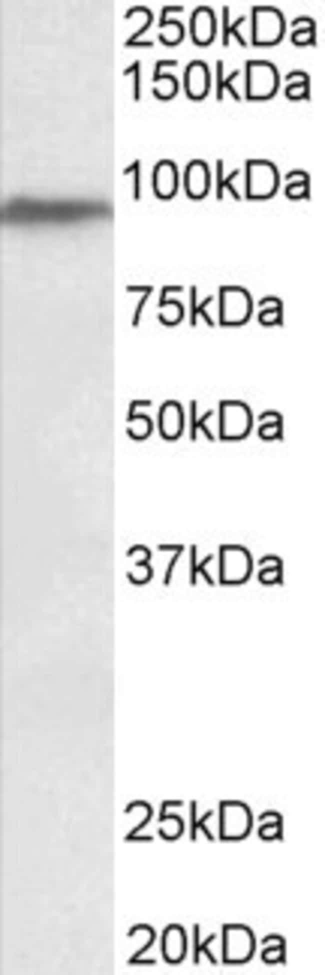 100 UG PTCHD3 / Patched-related protein