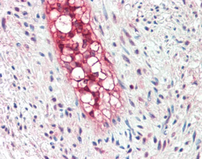 100 UG ECSM2 Antibody