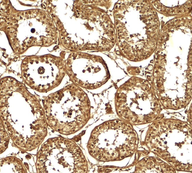 100UG AKAP4 Antibody