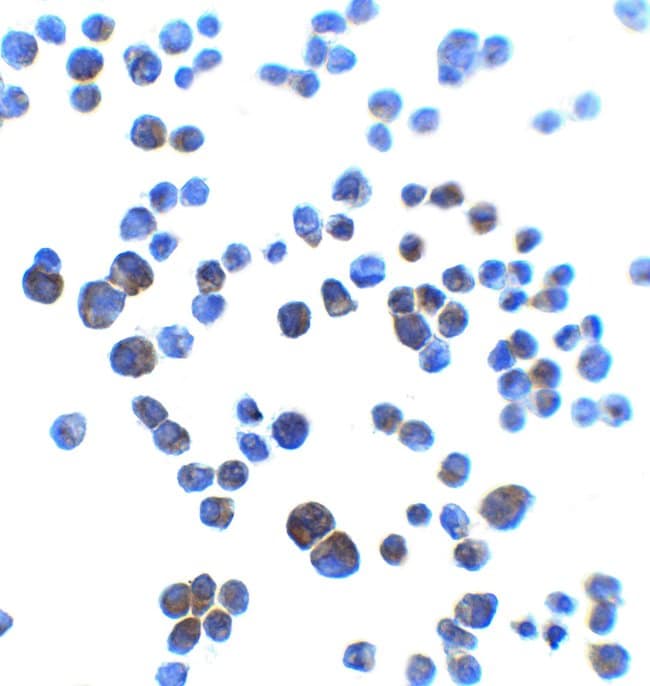 100UG AJAP1 Antibody