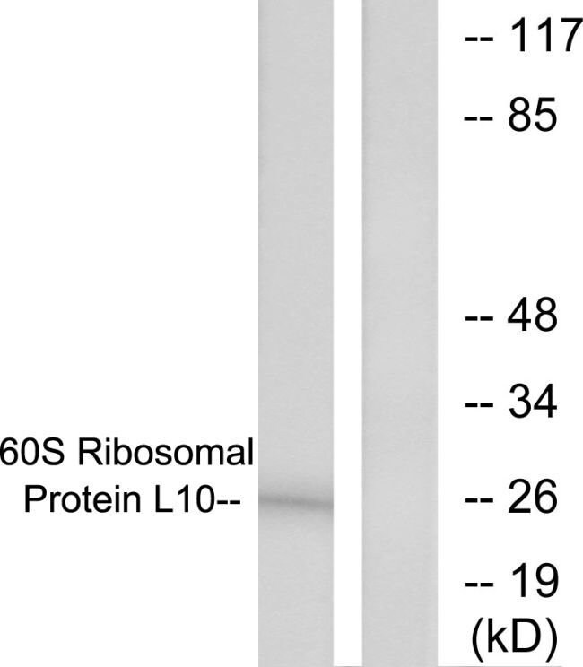 100UG 60S Ribosomal Protein L10 Antibody