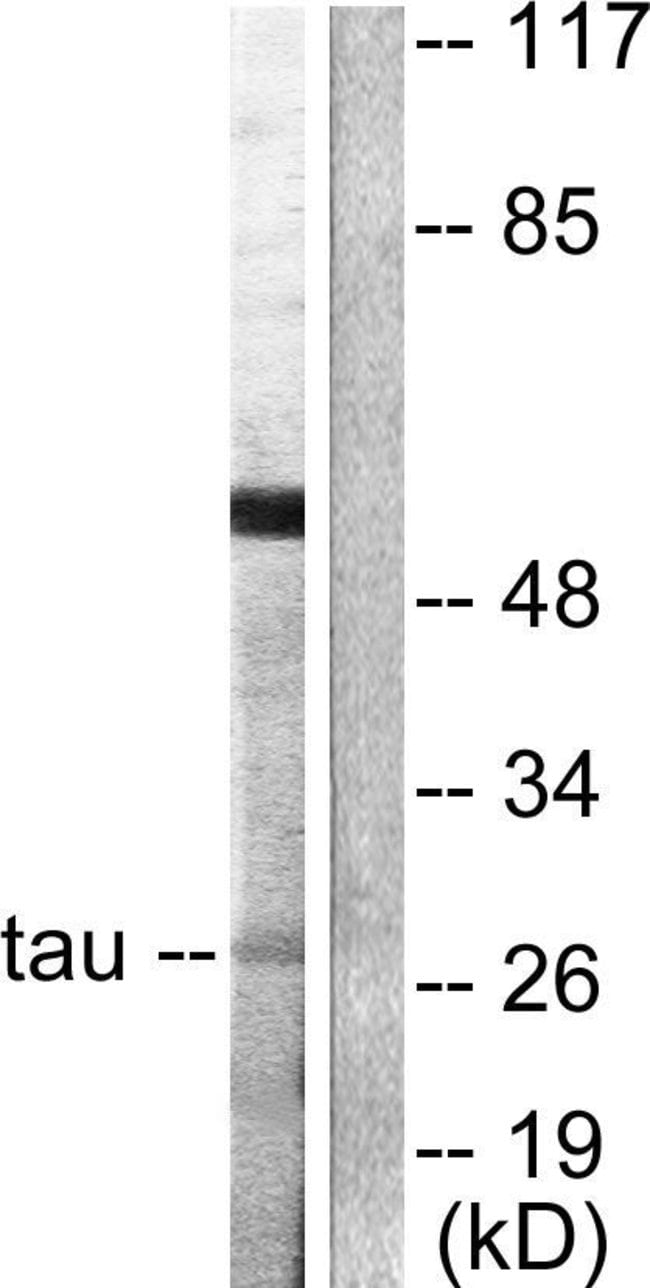 100UG 14-3-3 theta Antibody