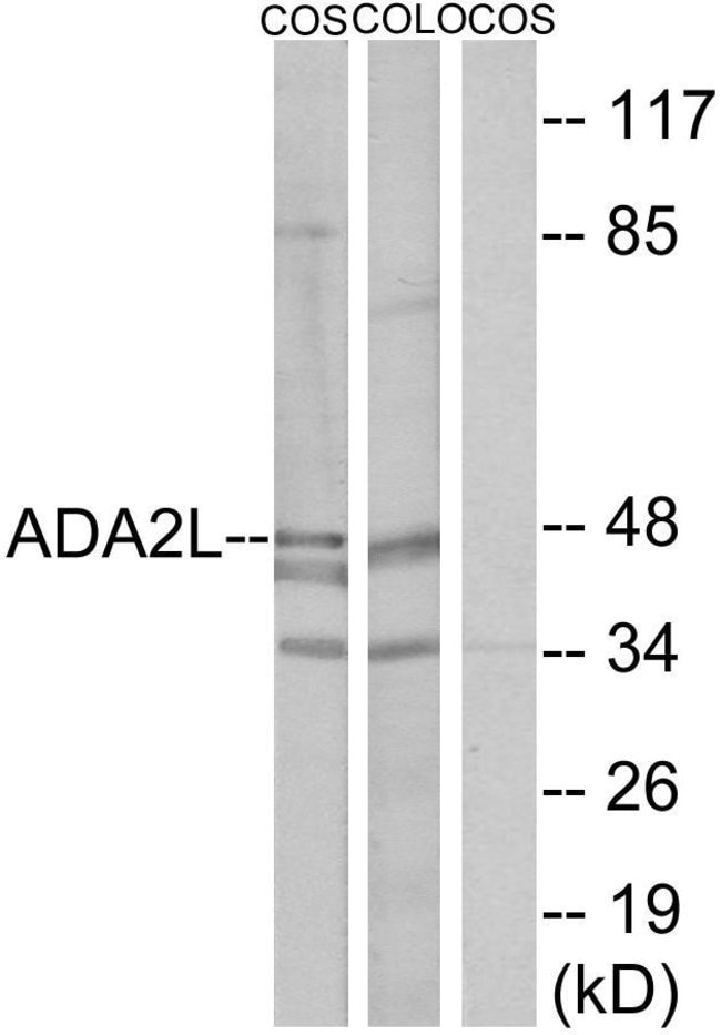 100UG ADA2L / TADA2L Antibody