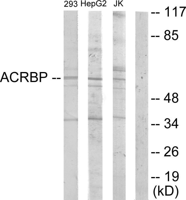 100UG ACRBP Antibody