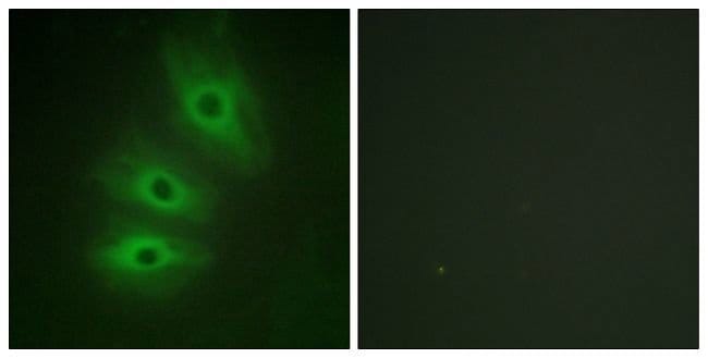 100UG ADCY5 + ADCY6 Antibody