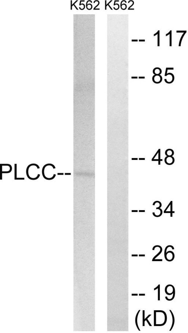 100UG AGPAT3 Antibody