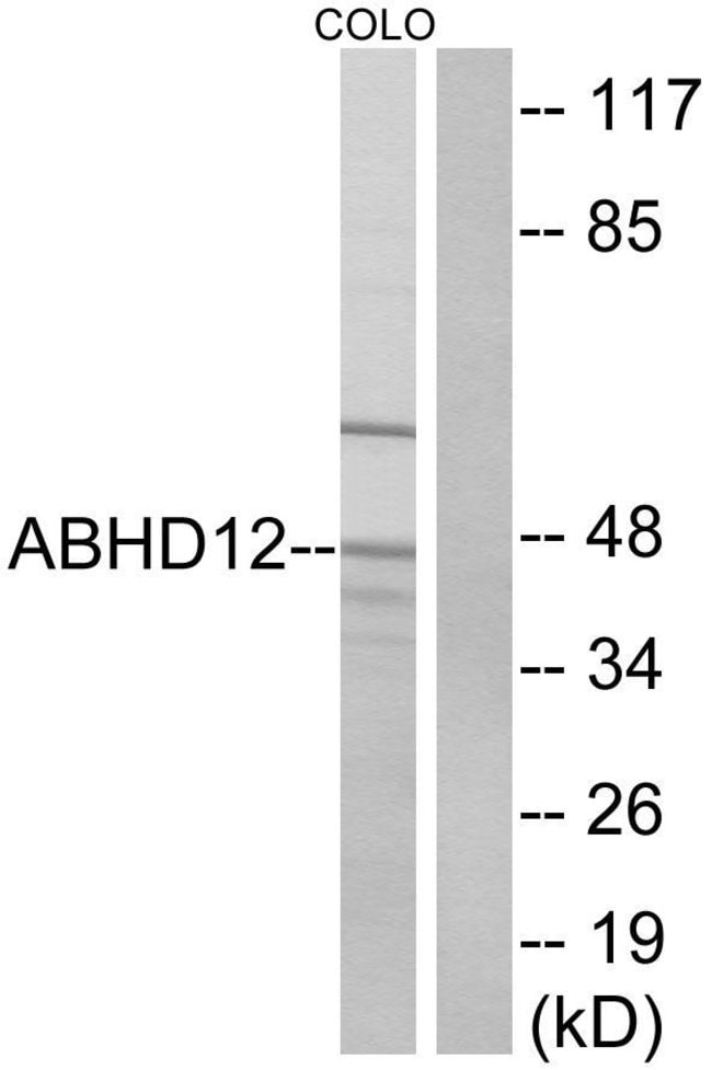 100UG ABHD12 Antibody