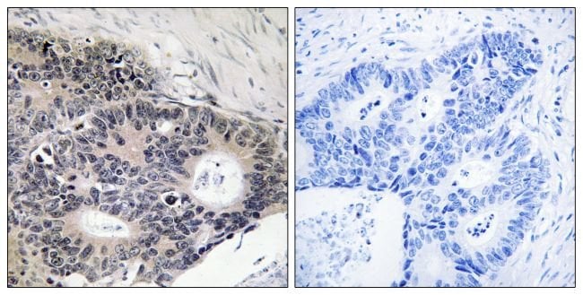 100UG ABHD12B Antibody