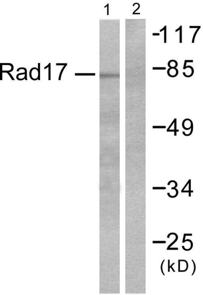 100UG ABHD14A Antibody