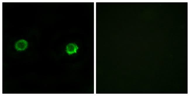 100UG ABHD2 Antibody