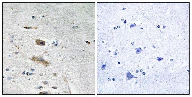 100UG ABHD4 Antibody