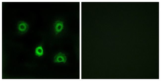 100UG ABHD6 Antibody