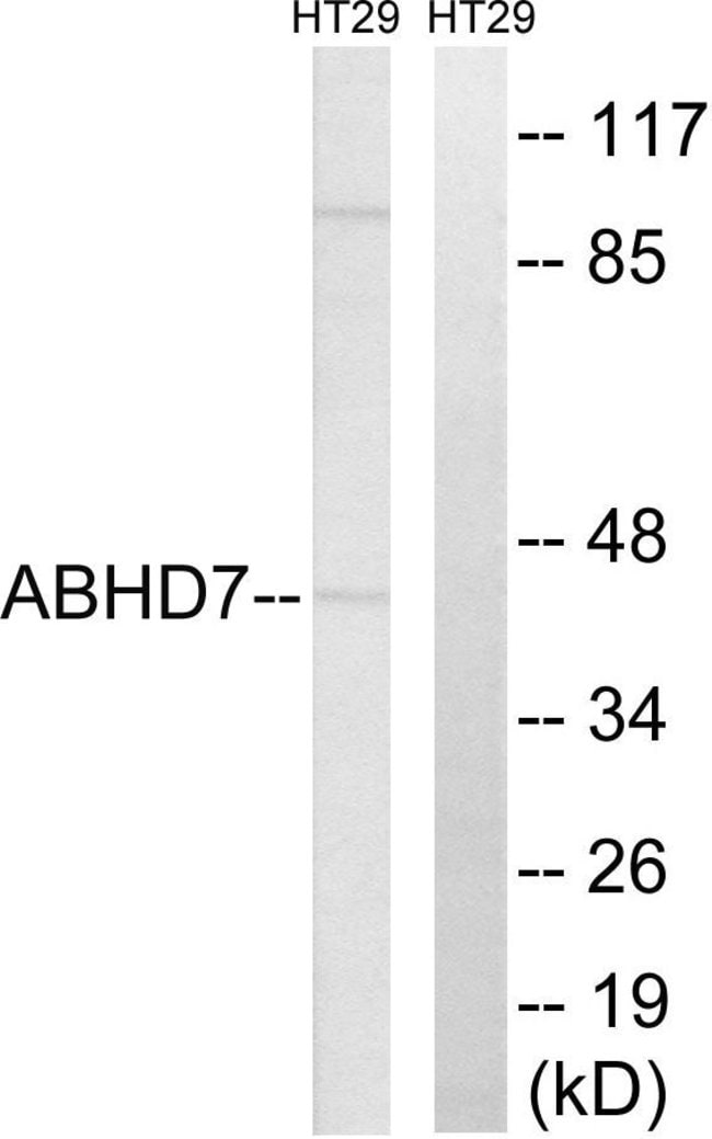 100UG ABHD7 Antibody