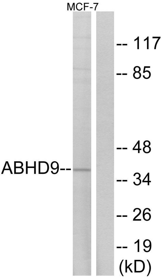 100UG ABHD9 Antibody