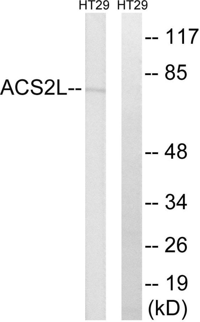 100UG ACSS1 / ACS2L Antibody