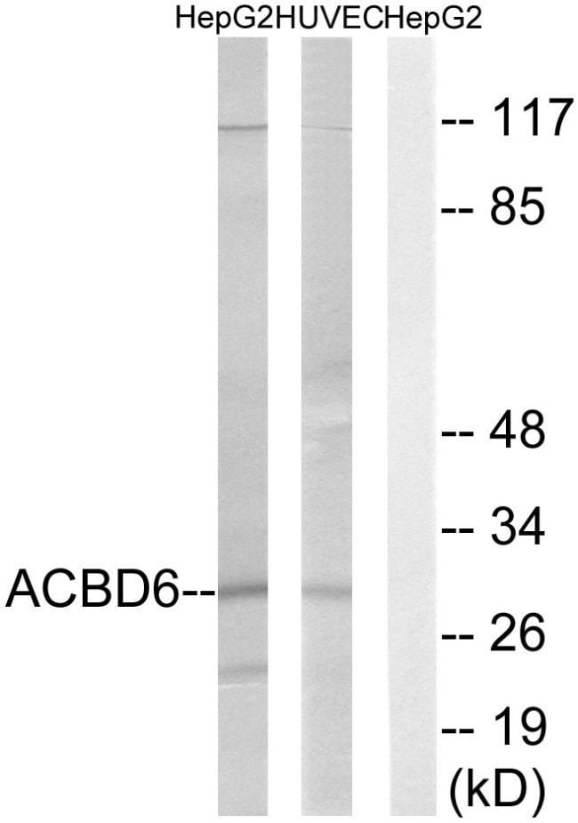 100UG ACBD6 Antibody