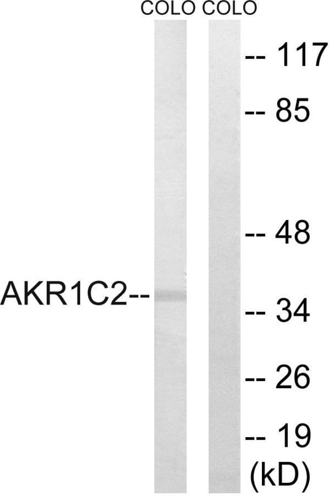 100UG AKR1C2 Antibody