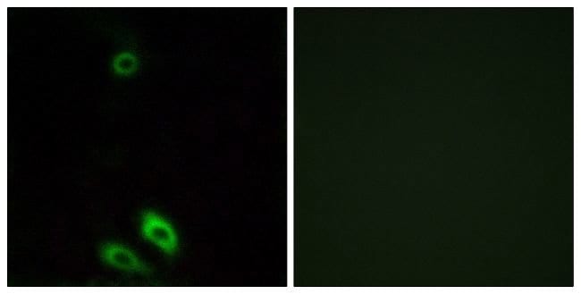 100UG AKR1CL1 Antibody