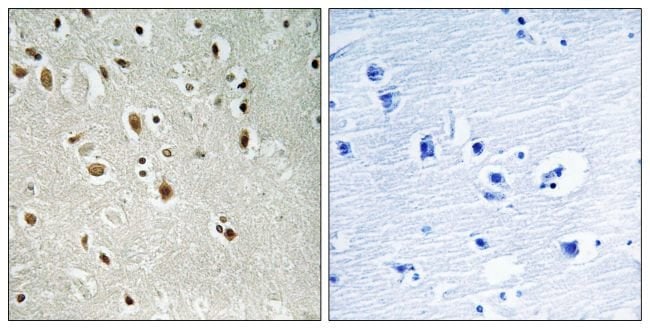 100UG A20A3 / ANKRD20A3 Antibody