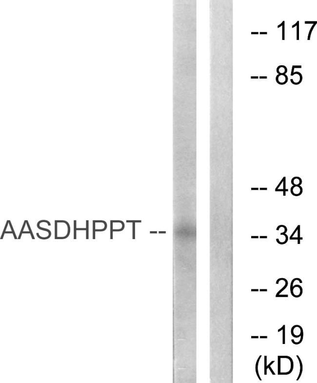 100UG AASDHPPT Antibody
