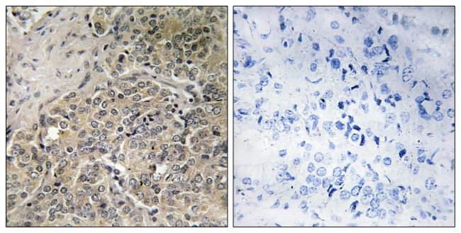 100UG A26C2 + A26C3 Antibody