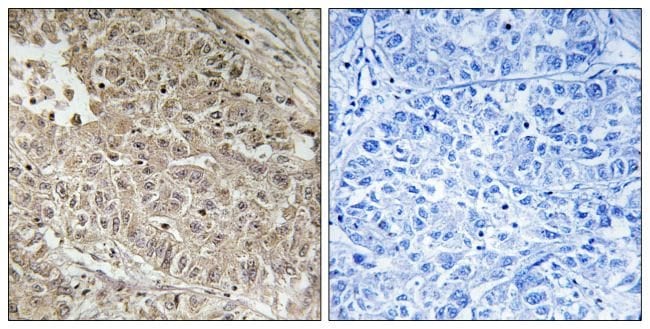 100UG ABCC13 Antibody