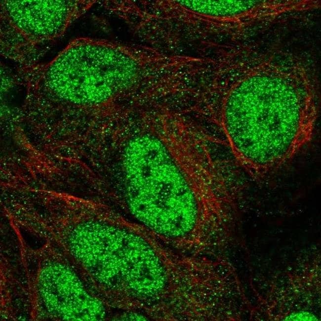 100 UL GOT1 Polyclonal Antibody