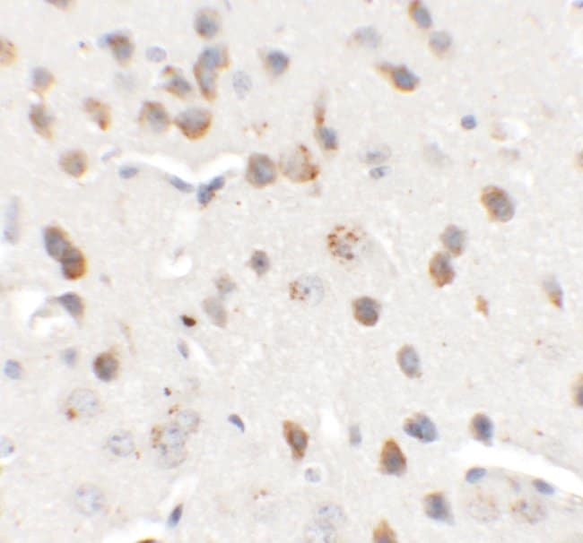 0.1MG CHD7 0.1 MG