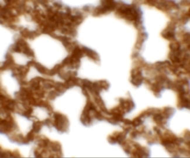 0.1MG NETO1 0.1 MG