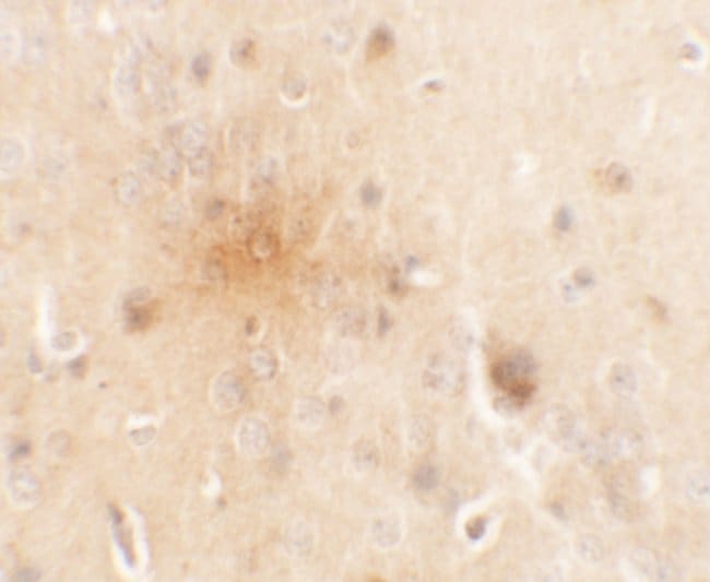 0.1MG SEC62 0.1 MG