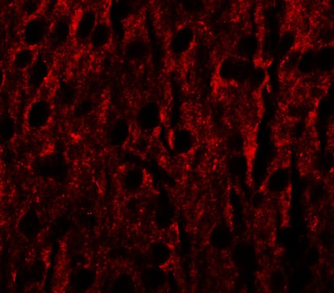 0.1MG RILPL1 0.1 MG