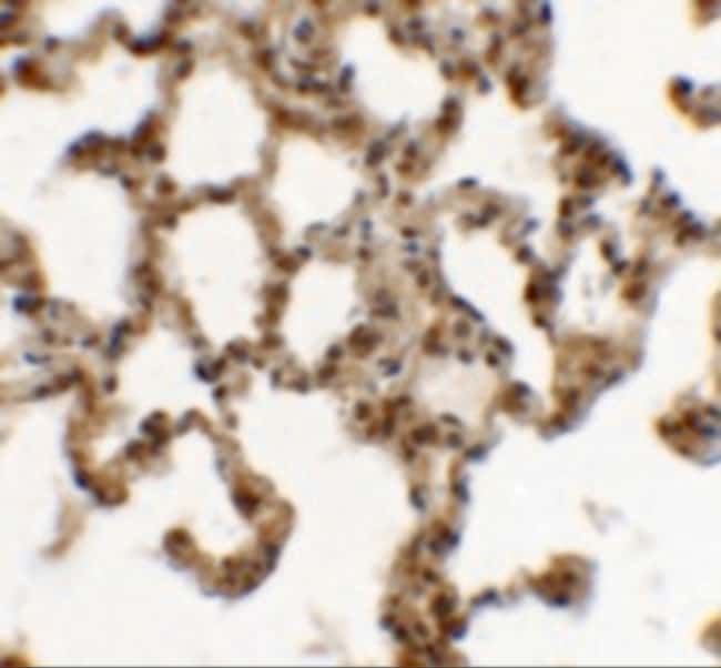 0.1MG SPINK7 0.1 MG