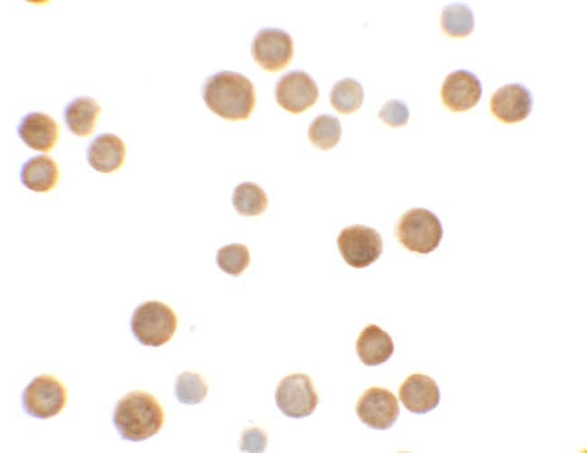 0.1MG ECRG4 0.1 MG