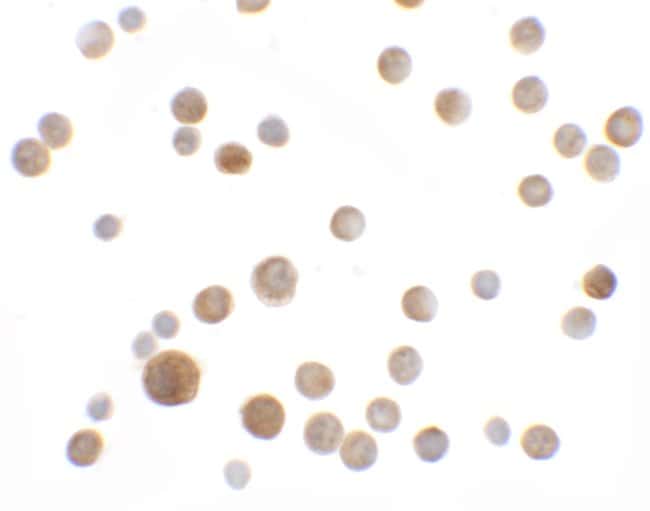 0.1MG SLC35D2 0.1 MG