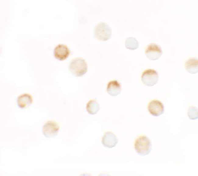 0.1MG SLC35D3 0.1 MG
